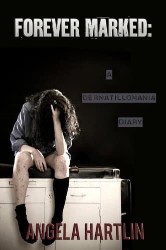 FOREVER MARKED: A Dermatillomania Diary