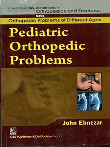 John Ebnezar CBS Handbooks in Orthopedics and Factures: Orthopedic Problems of Different Ages: Pediatric Orthopedic Problems