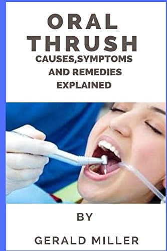 Oral thrush: oral thrush treatment adult candida medicine for relief baby anti-fungal probiotic violet natural cure gentian nystacin mouthwash