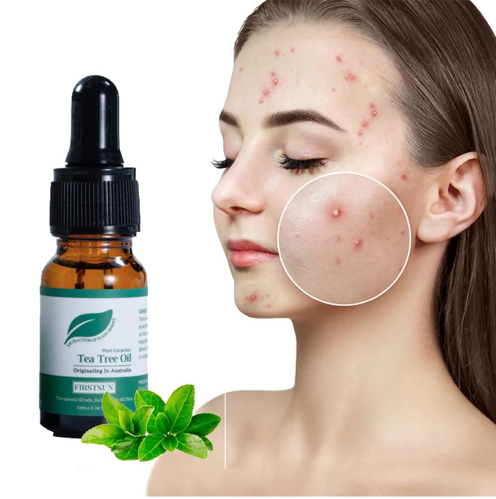 Madi Kay Designs Acne Treatment Tea Tree Essential Oil Anti Acne Fade Ace Mark Face Essence Shrink Pores Brightens Skin Tone Skin Care Products