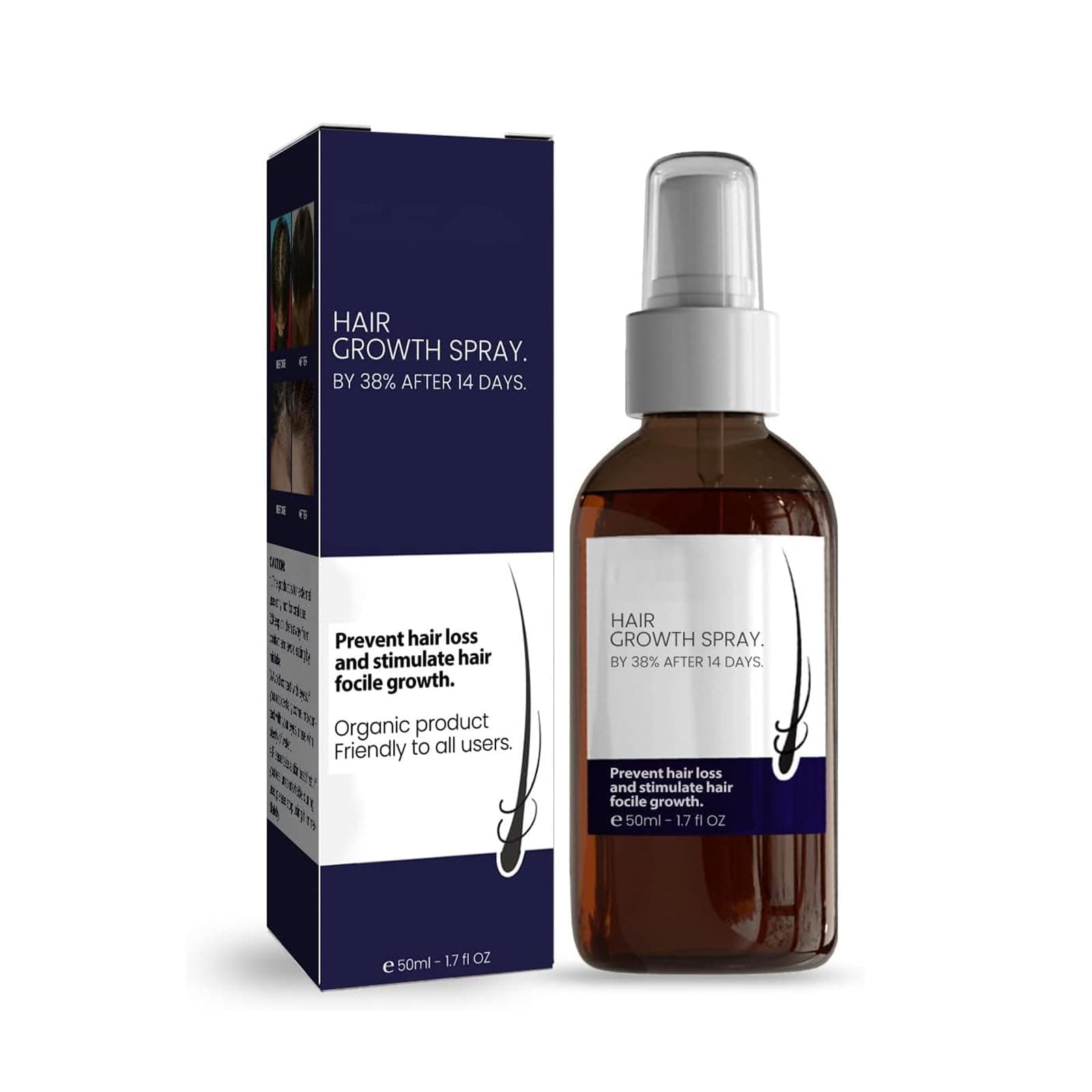 Hair Growth Spray, Natural Regrowth and Thickening Oil for Stronger Hair, Best Growth Products for Women & Men (1Pcs)