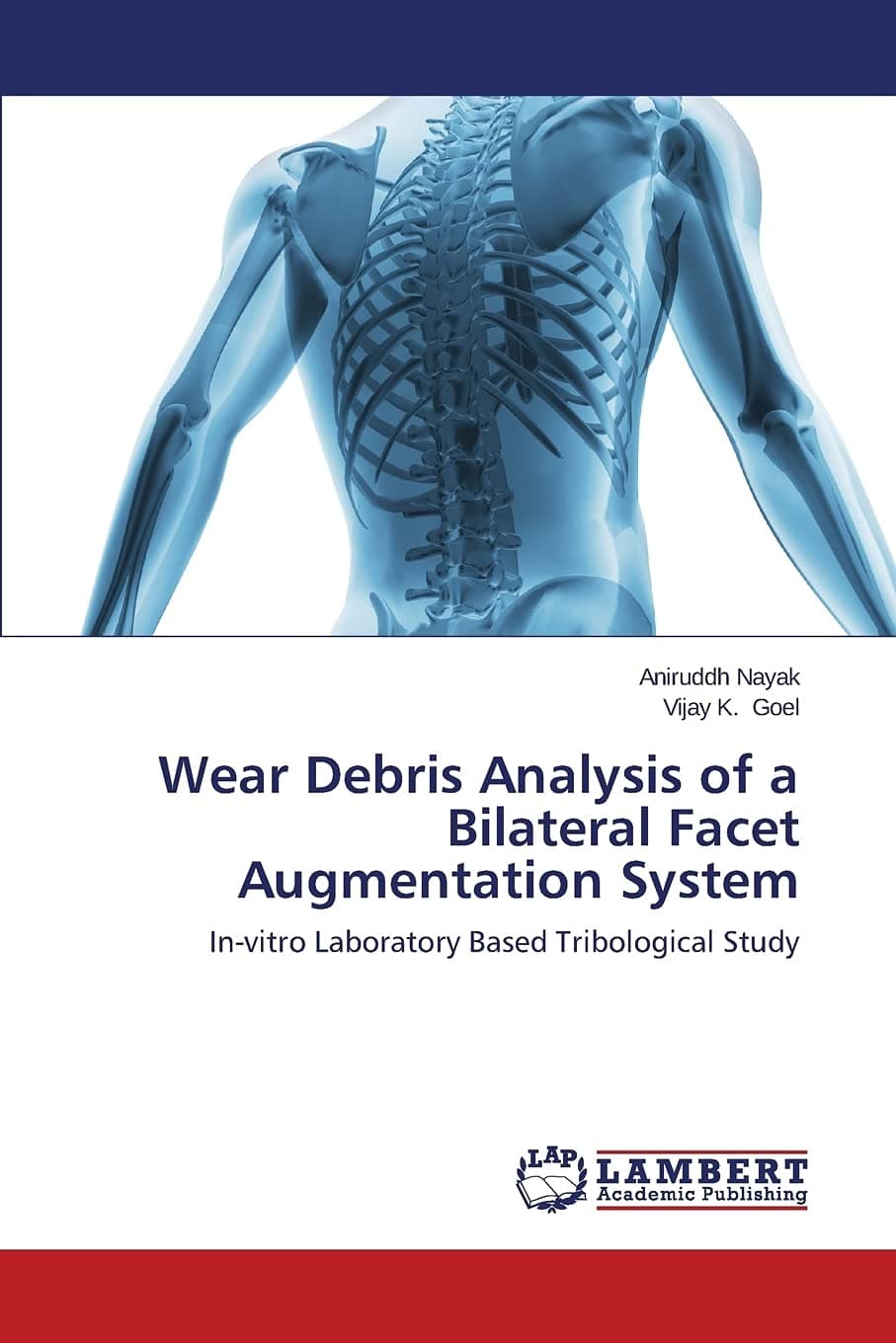 Wear Debris Analysis of a Bilateral Facet Augmentation System: In-vitro Laboratory Based Tribological Study Paperback – April 23, 2014