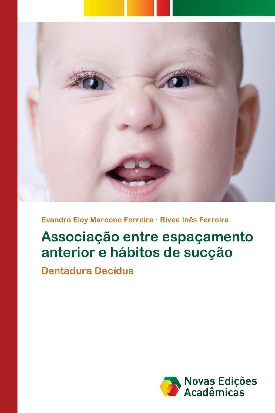 Associação entre espaçamento anterior e hábitos de sucção: Dentadura Decídua (Portuguese Edition)