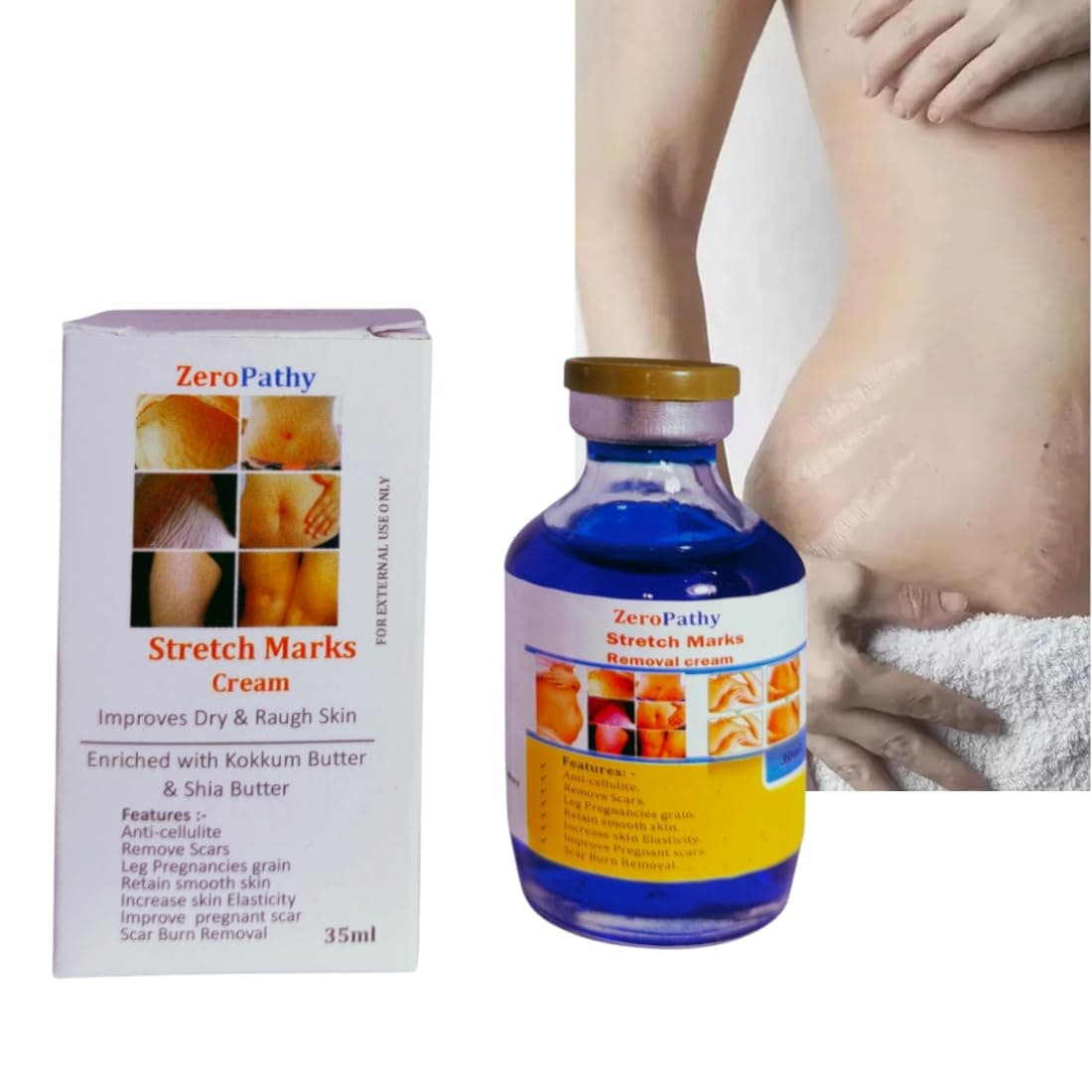 Burn scar clear cream for face body old scars accident scar injury scar injury spots pimple marks for men women. with Aloe Vera Scar Lighte for Burns & Acne Essential Body Cream 35ml