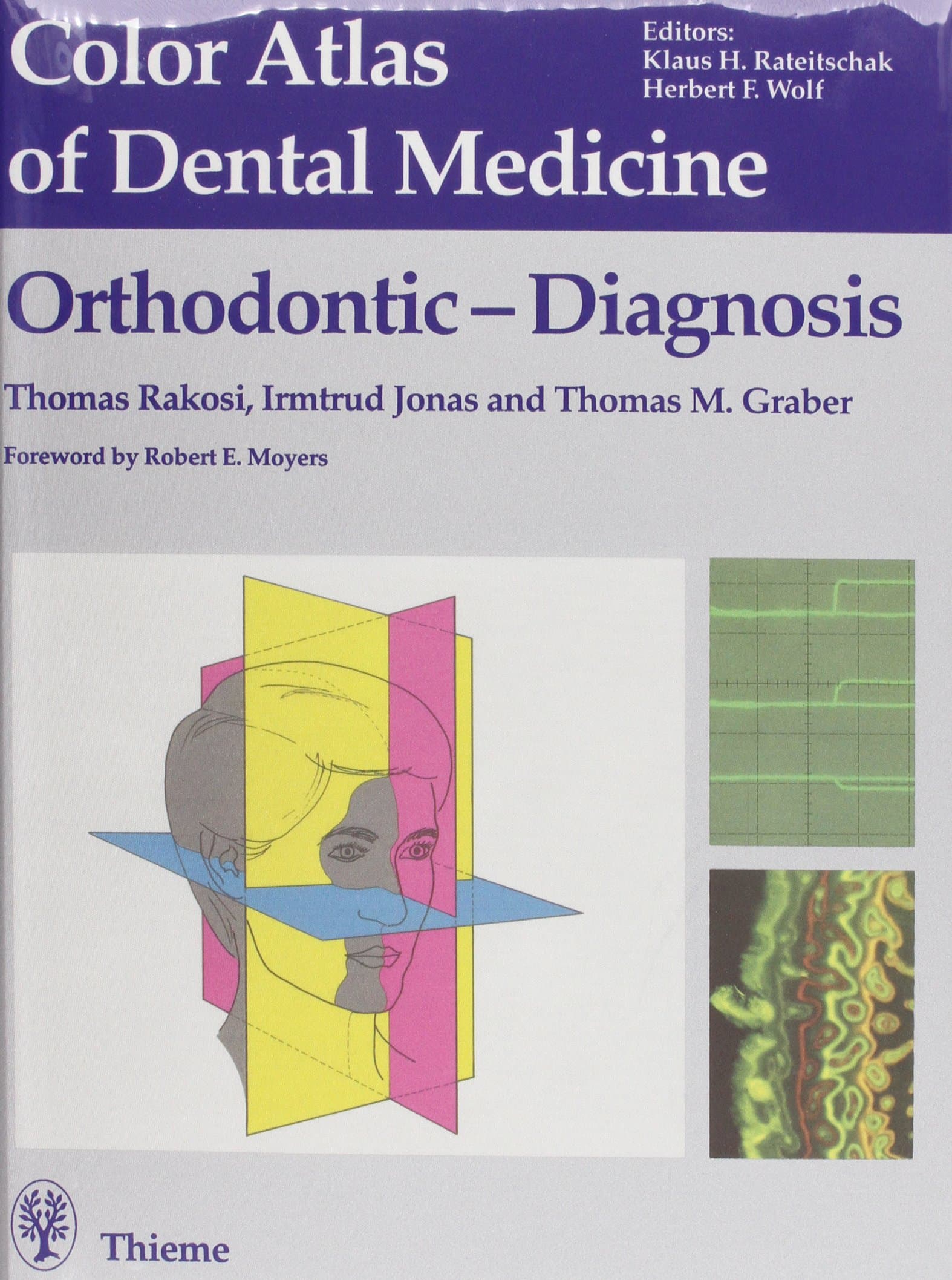 Orthodontic - Diagnosis (Farbatlanten engl.) Hardcover – 1 Jan. 1993