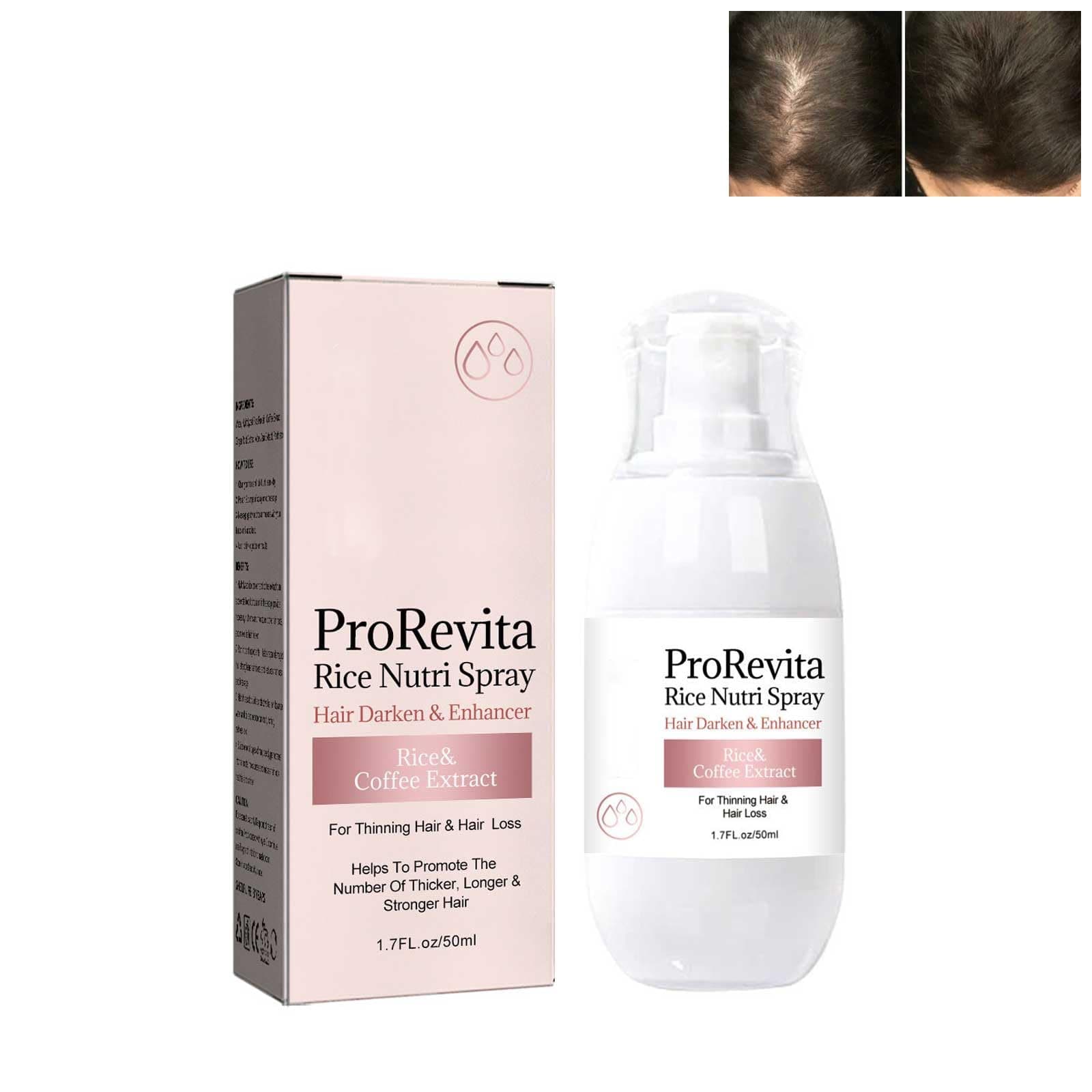 Bello Hair Helper Spray,Rice Water Serum For Hair Growth Spray,Bello Hair Helper Growth Spray,Rice Water Spray For Hair Growth Leave In,Bello Hair Helper Spray For Thinning Hair (1PCS)