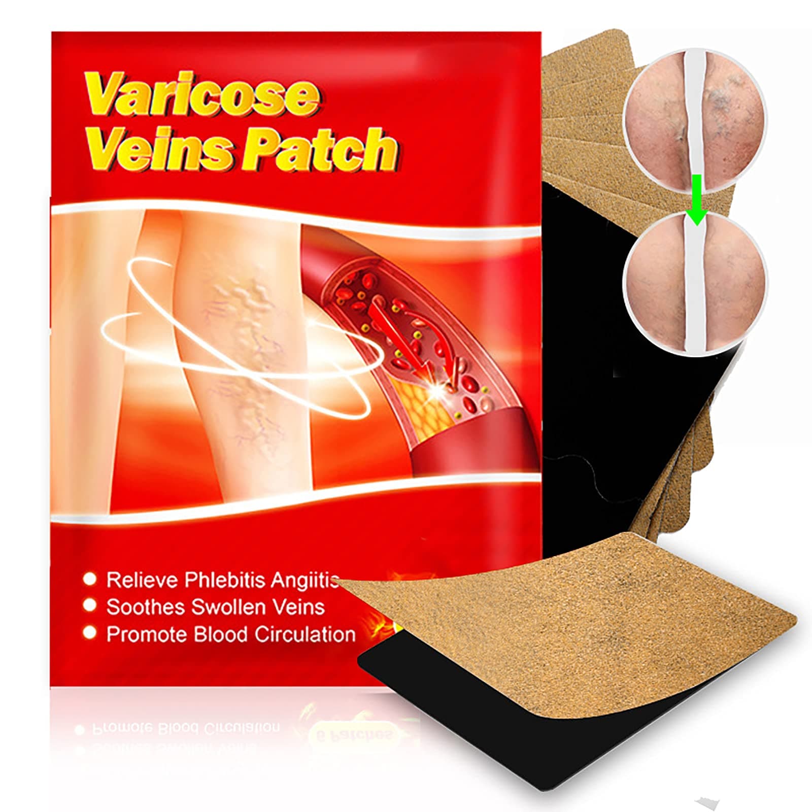 Xshows Varicose Veins Patch, Varicose Veins Herbal Healing Patch for Legs, Effectively Relieve Leg Pain, Spider Veins, Promote Blood Circulation Smooth and Metabolism