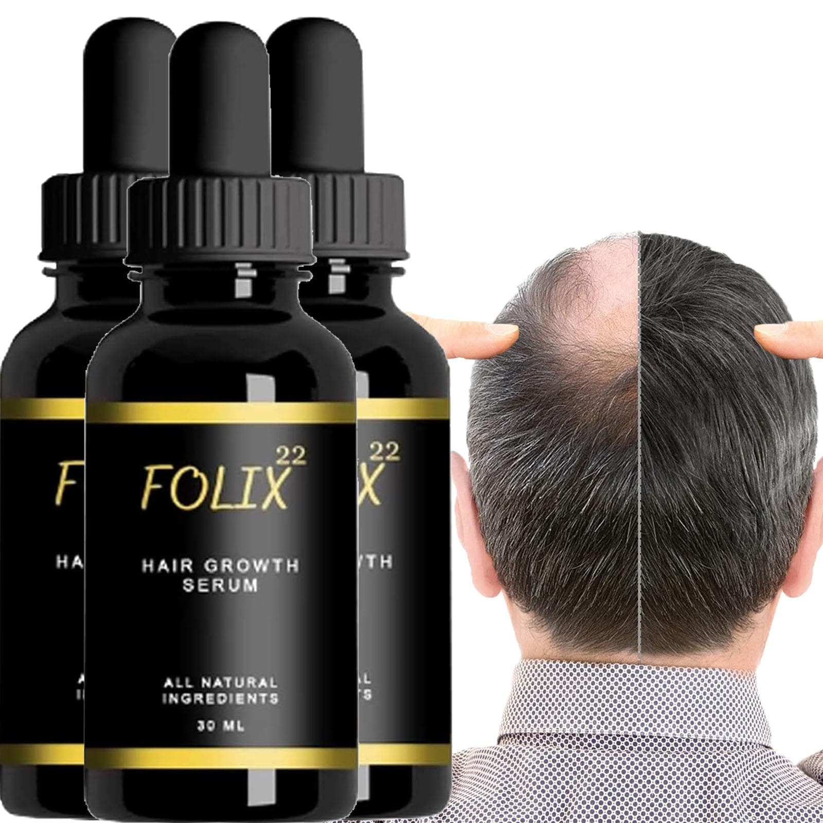 Folix22, Folix22 Hair Growth Formula, Folix 22 Hair Growth, Folix22 Hair Growth Serum, Hair Growth Formula for Men Women (3PCS)